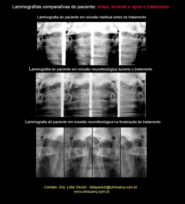 33laminografias comparativas