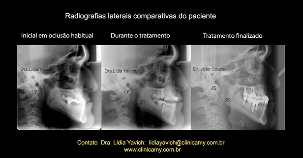 34 teles comparativas
