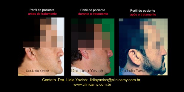 36 perfis comparativos 2