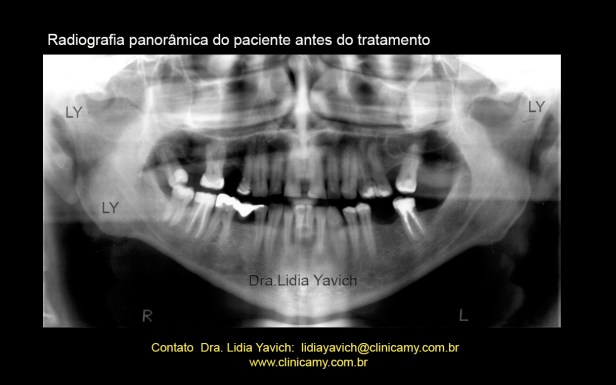 5 PANORAMICA INICIAL