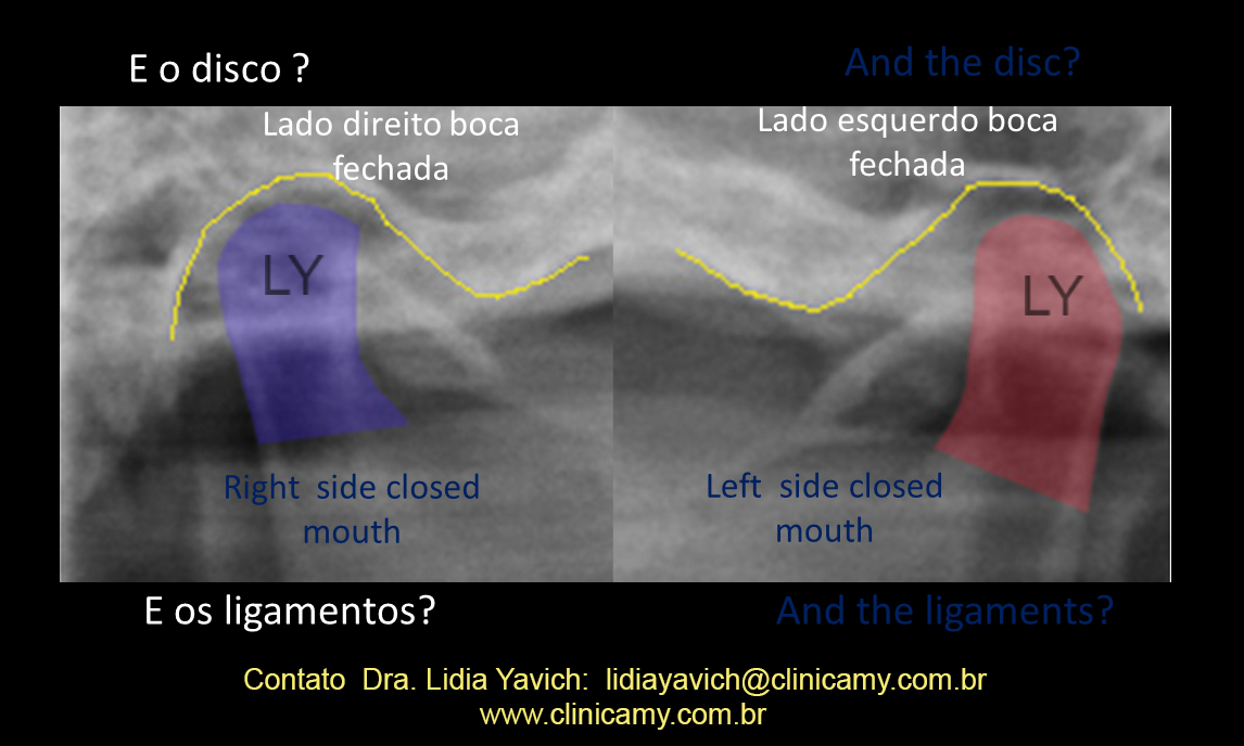 10 ampliação laminografia