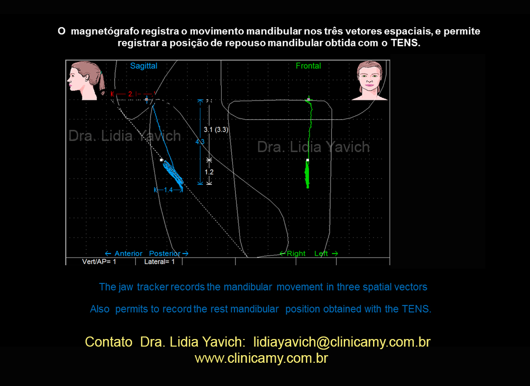 24 registro magnetografico