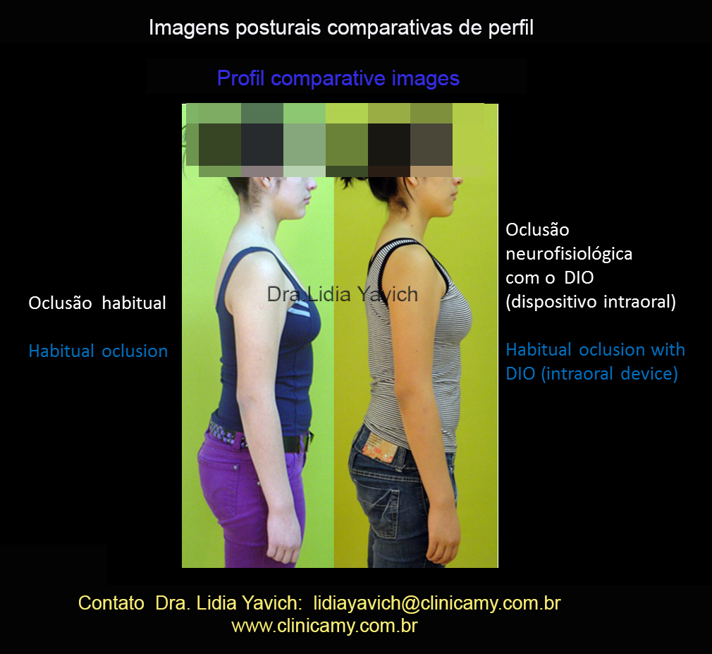 28 perfil comparativas