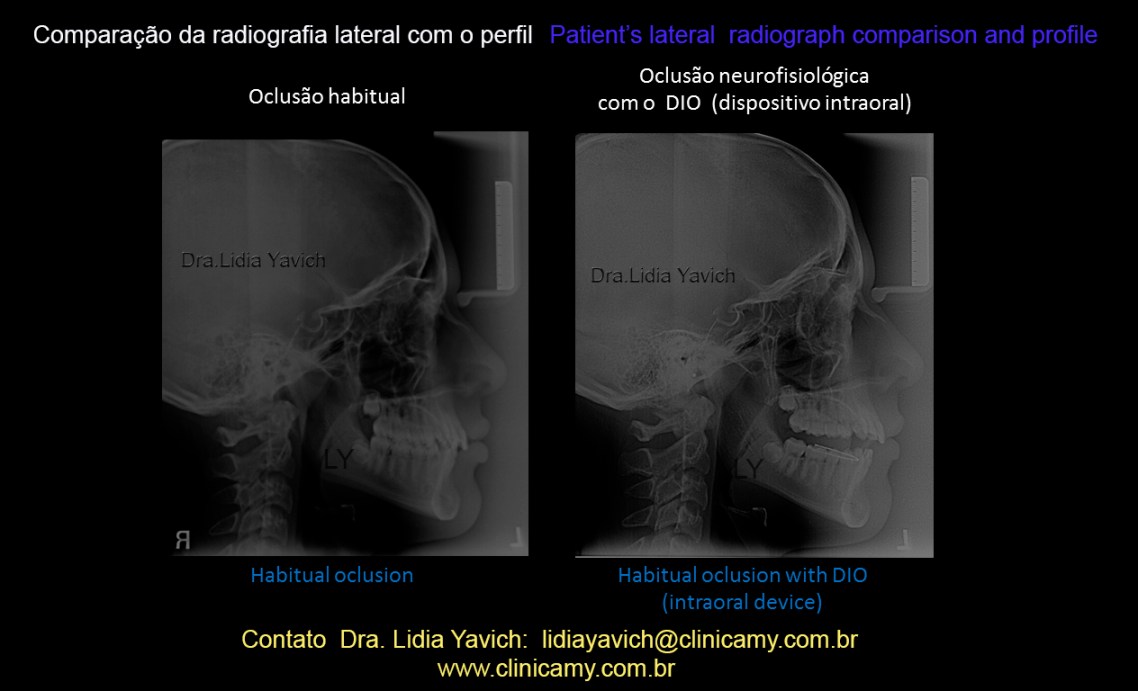 31 comparativas do perfil