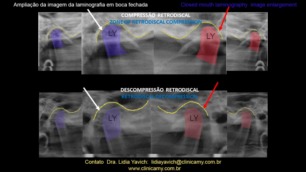 34 lamino comparativas COR AMPLIADAS