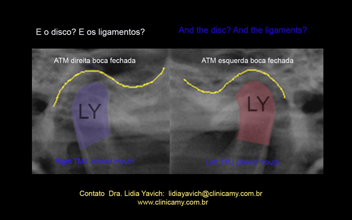 35 lamino comparativas COR AMPLIADAS PROVISORIAS