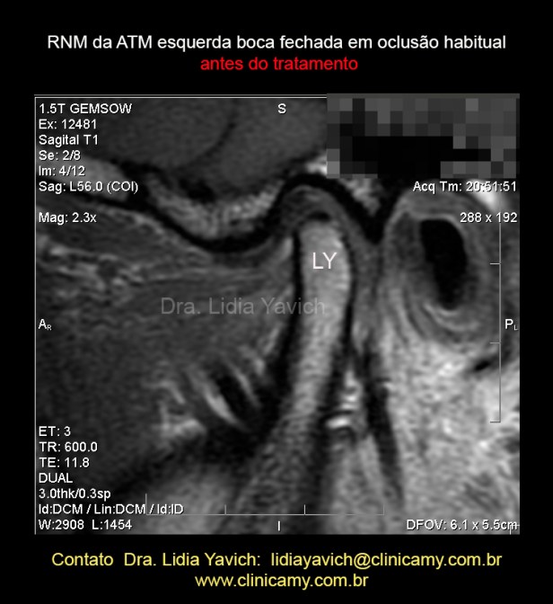 13 A RES. ESQ 1 INICIAL
