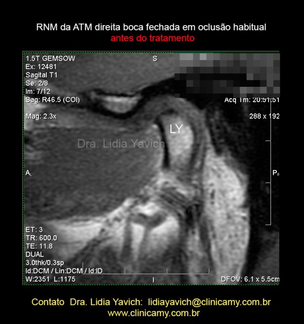 13 C RES. DIR 1 INICIAL