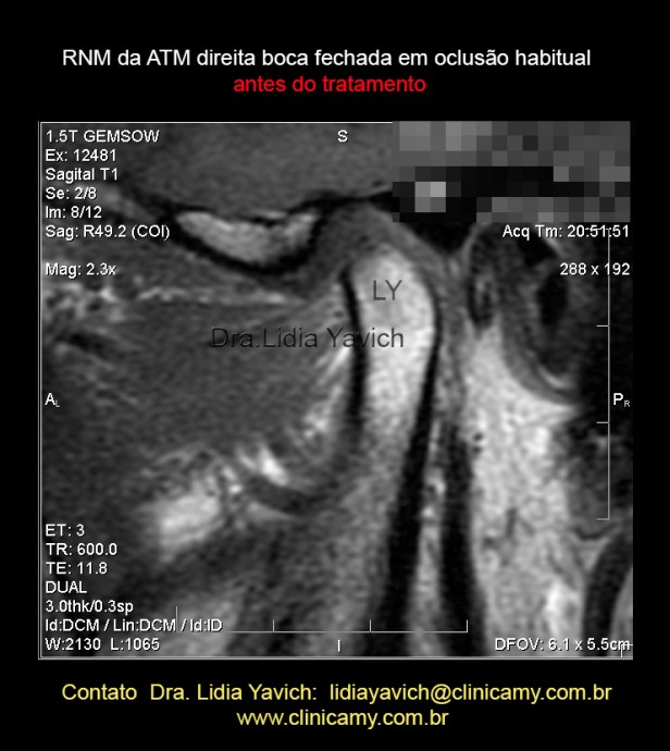13 D RES. DIR 2 INICIAL