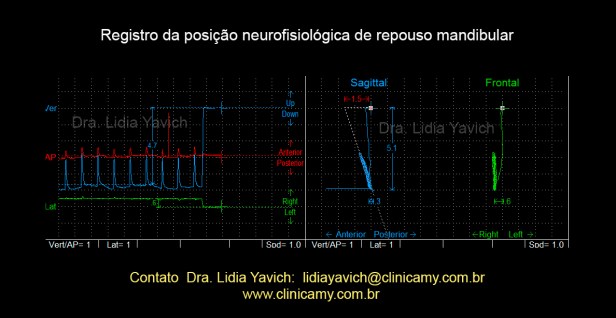 13G REGISTRO NEUROFISIOLOGICO