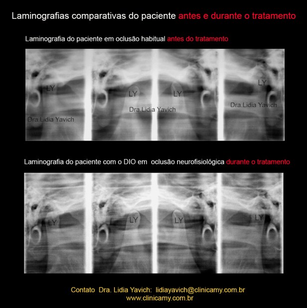 18 LAMINOGRAFIAS COMPARATIVAS