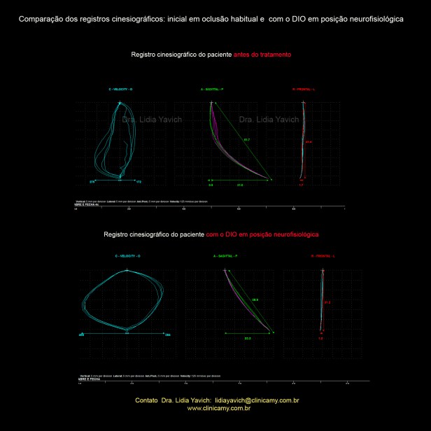 20 A cinesiografias COMPARATIVAS