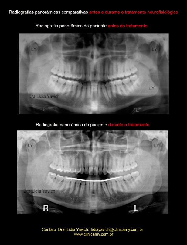 20 PANORAMICAS COMPARATIVAS