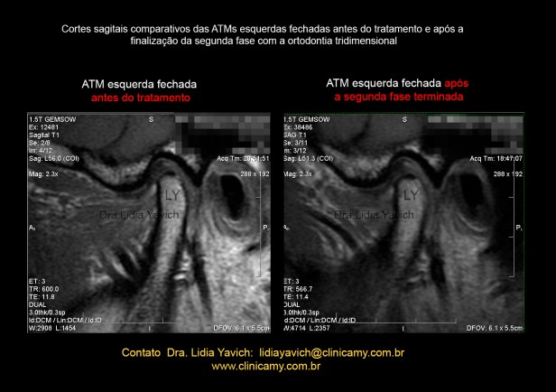 32 ressonancia comparativa 1