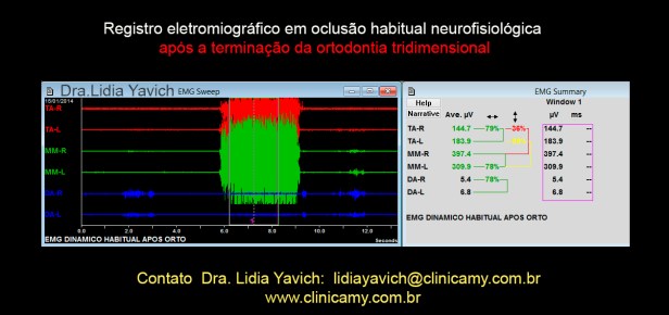 36 eletromiografia final