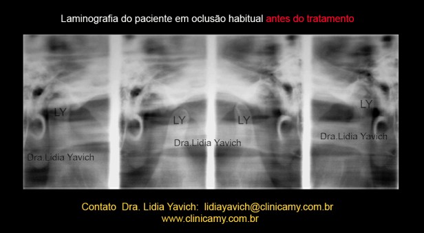 8 LAMINOGRAFIA INICIAL