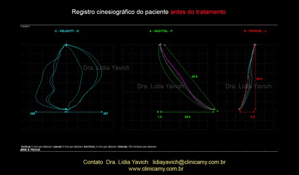 10 ABERTURA E FECH INICIAL