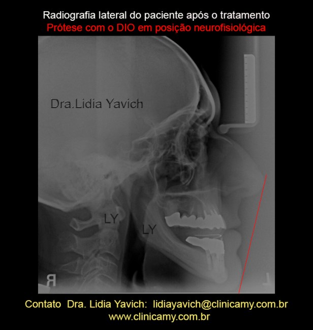 13CTELERRADIOG COM DIO LINHA