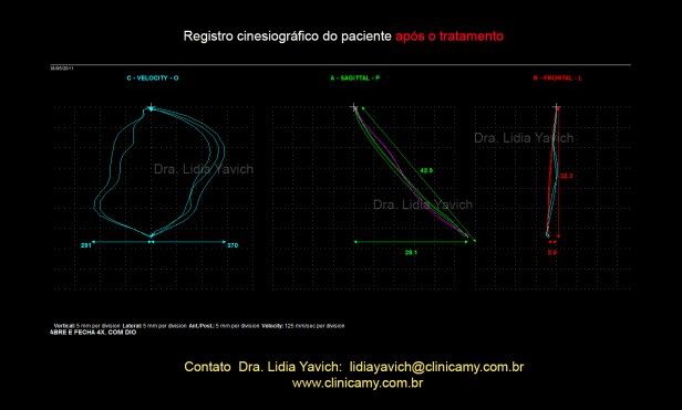 16 ABERTURA E FECH COM O DIO