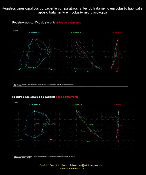 17 ABERTURA E FECH COMPARATIVOS
