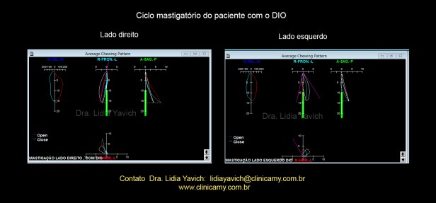 18 CICLOS MASTIGATORIOS COM DIO