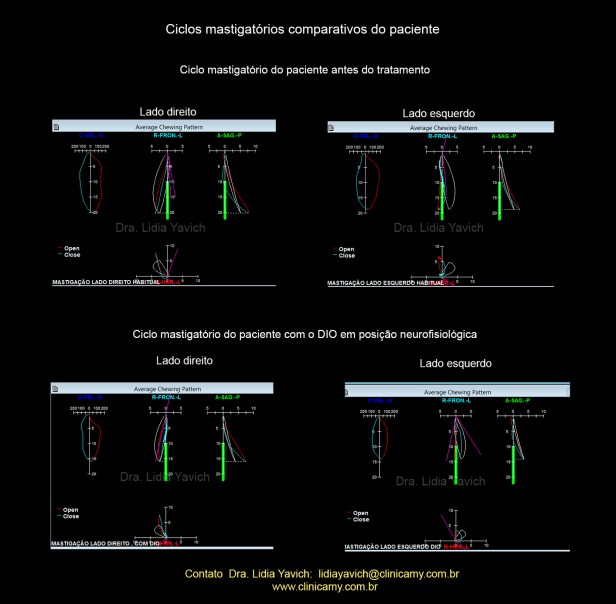19 CICLOS MASTIGATORIOS SEM E COM DIO