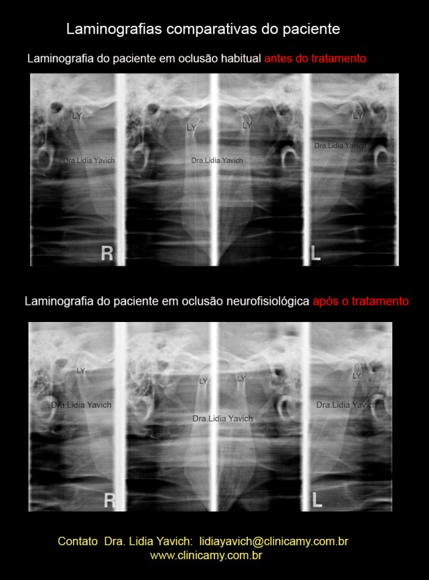 21 LAMINOGRAFIAS COMPARATIVAS