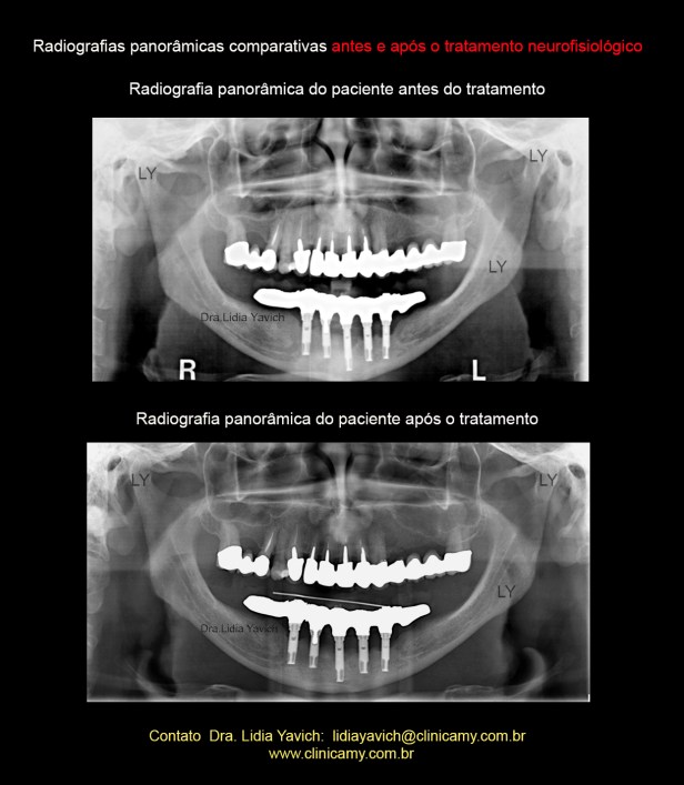 23 PANORAMICAS COMPARATIVAS
