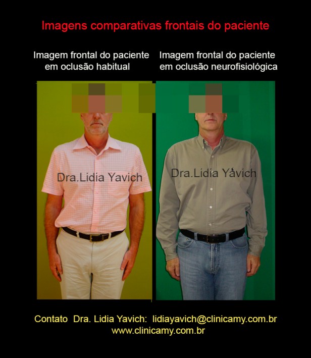 24 frontal comparativos