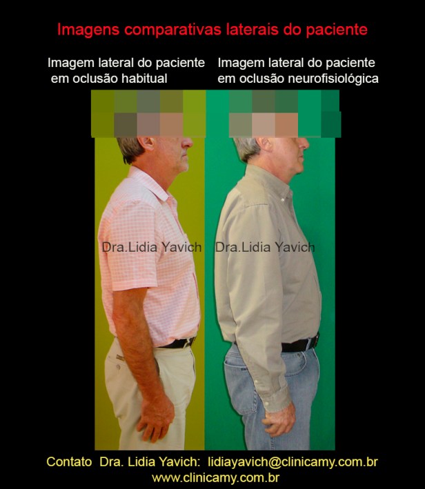 25 perfis comparativos