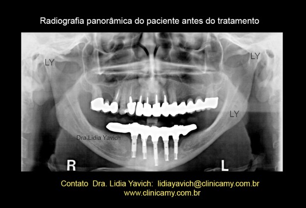 5 PANORAMICA INICIAL