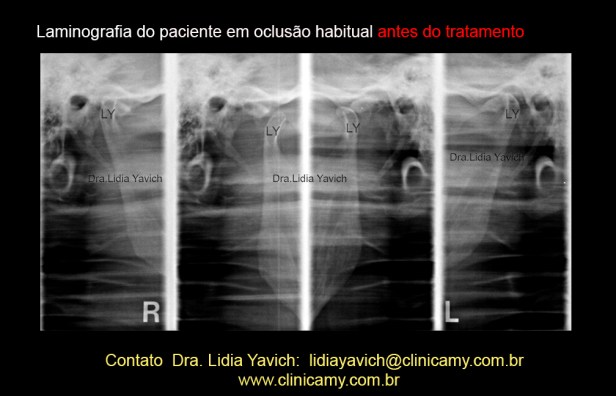 6 LAMINOGRAFIA INICIAL