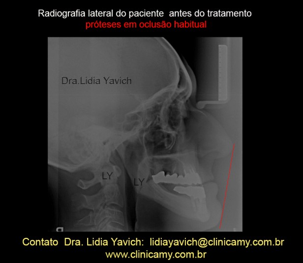 7A TELERRADIOG INICIAL LINHA