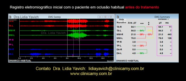 9 ELETROMIOGRAFIA INICIAL