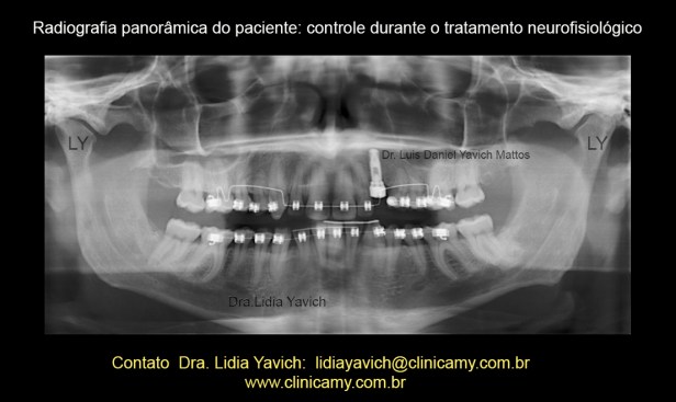 19 PANORAMICA NO TRAT
