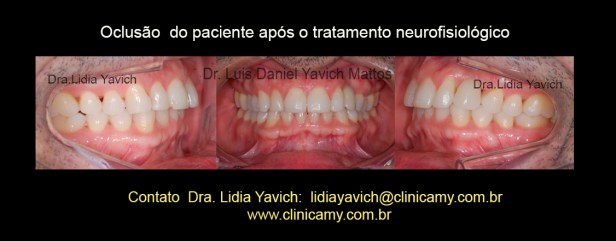 22 DENTES FINAL