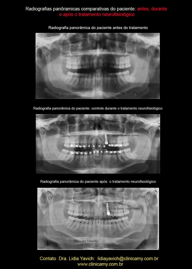26A PANORAMICACOMPARATIVAS