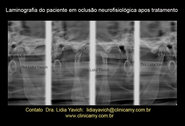 27 laminograpfia final