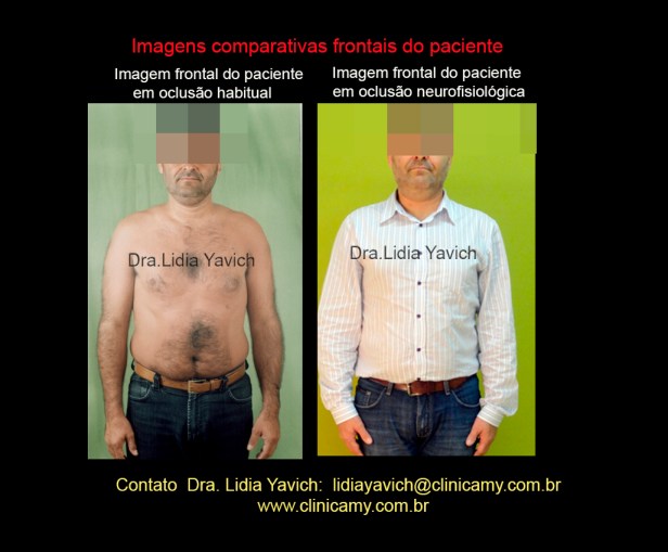 32 COMPARAÇAO IMAGEM FRONTAL