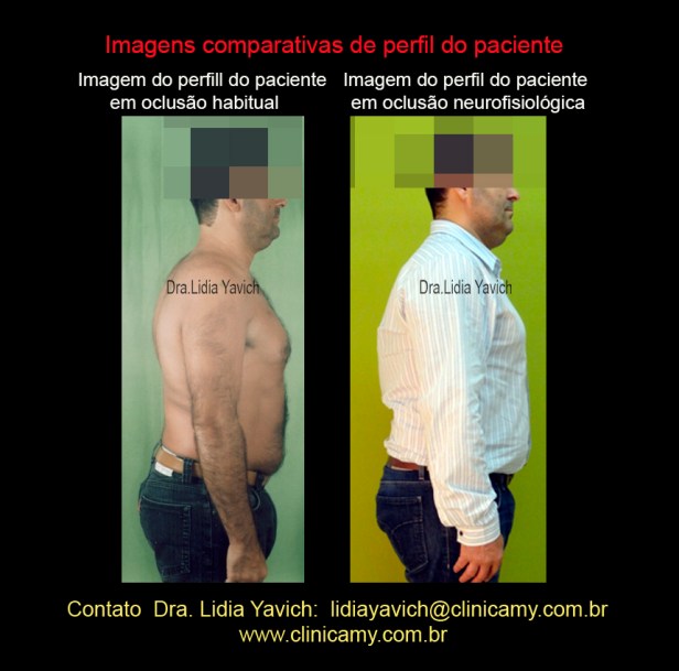 32 COMPARAÇAO PERFIL