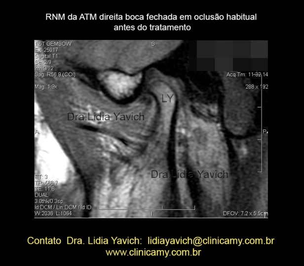 11 RESS DIR 1 BOCA FECHADA