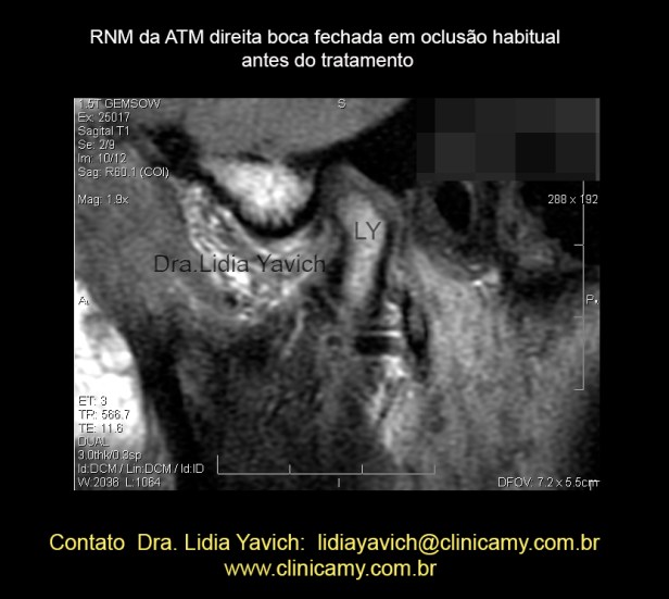 11 RESS DIR 2 BOCA FECHADA