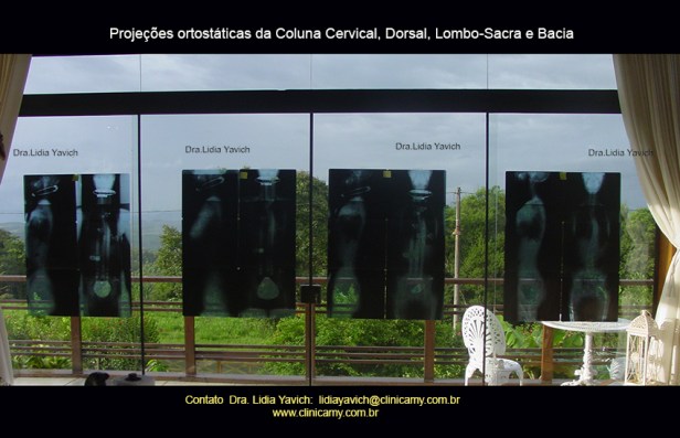 1bjanela radiografia