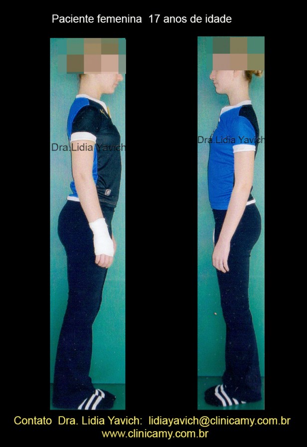 2 perfil direito e esquerdo