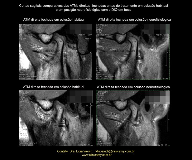 20 ress COMP dir  1 e 2