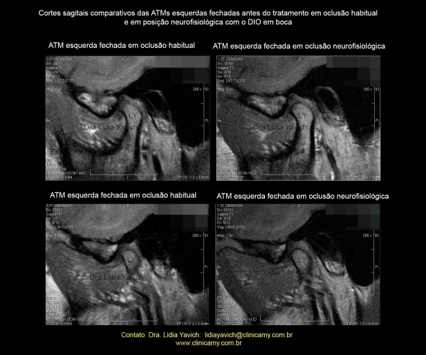 21 ress COMP ESQ  1 e 2