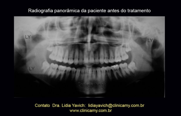 7 panoramica inicial