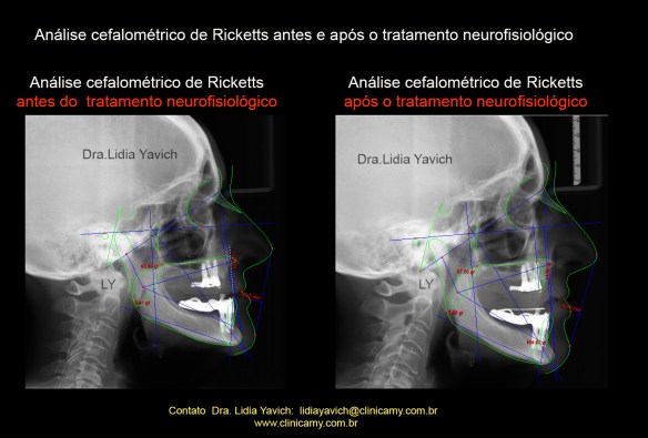 27 CEF COMPARATIVAS