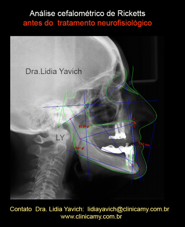 cefalometria 2013 PORTUGUES