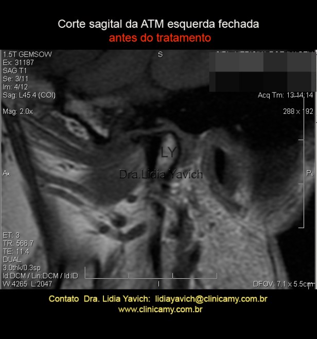 13 RNM  ESQ  INICIAL